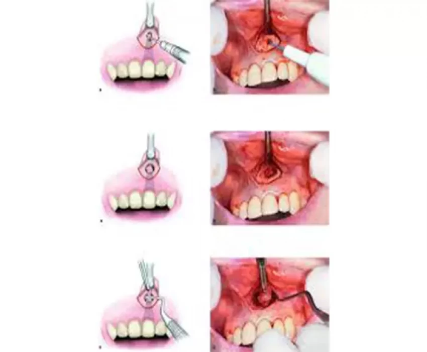 saraswati dental college