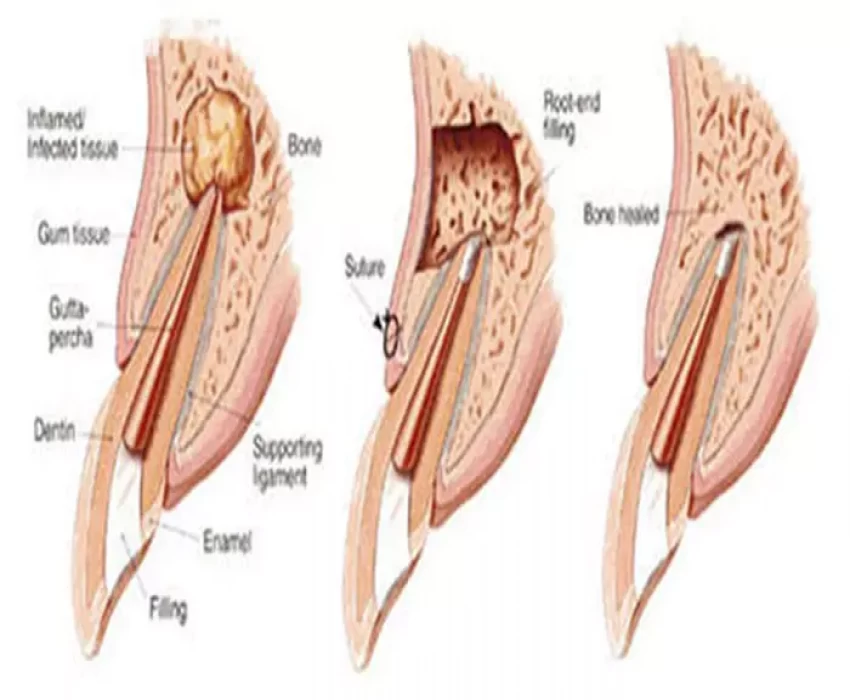 saraswati dental college