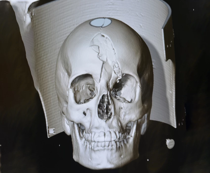 saraswati dental college