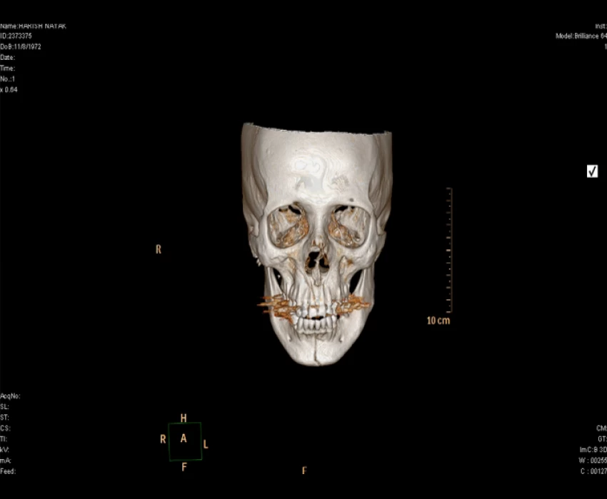 saraswati dental college
