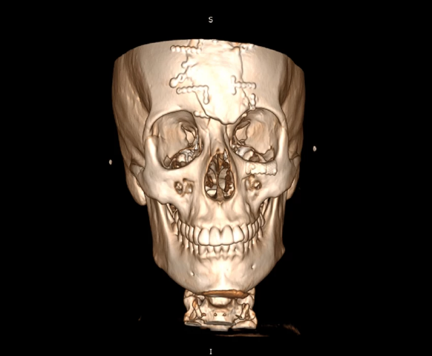 saraswati dental college