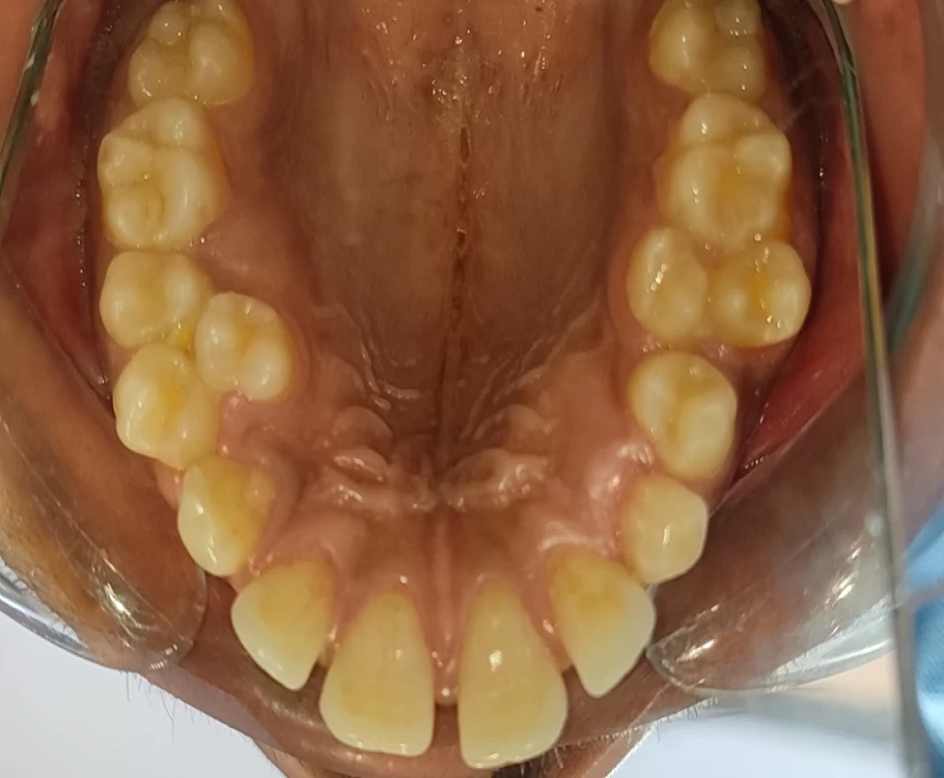 saraswati dental college