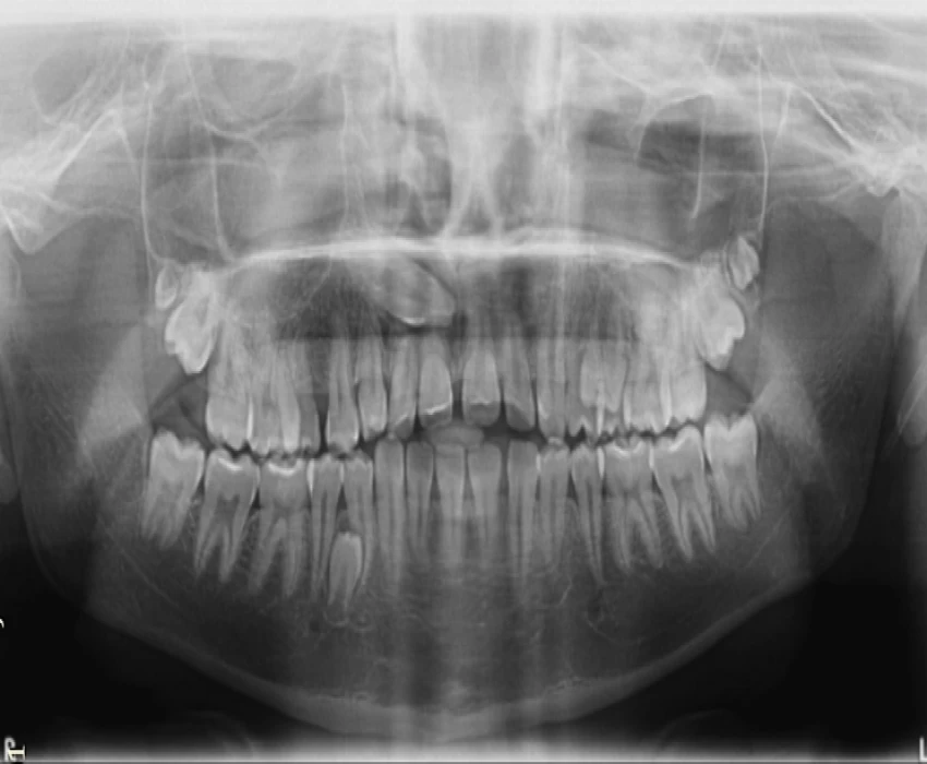 saraswati dental college