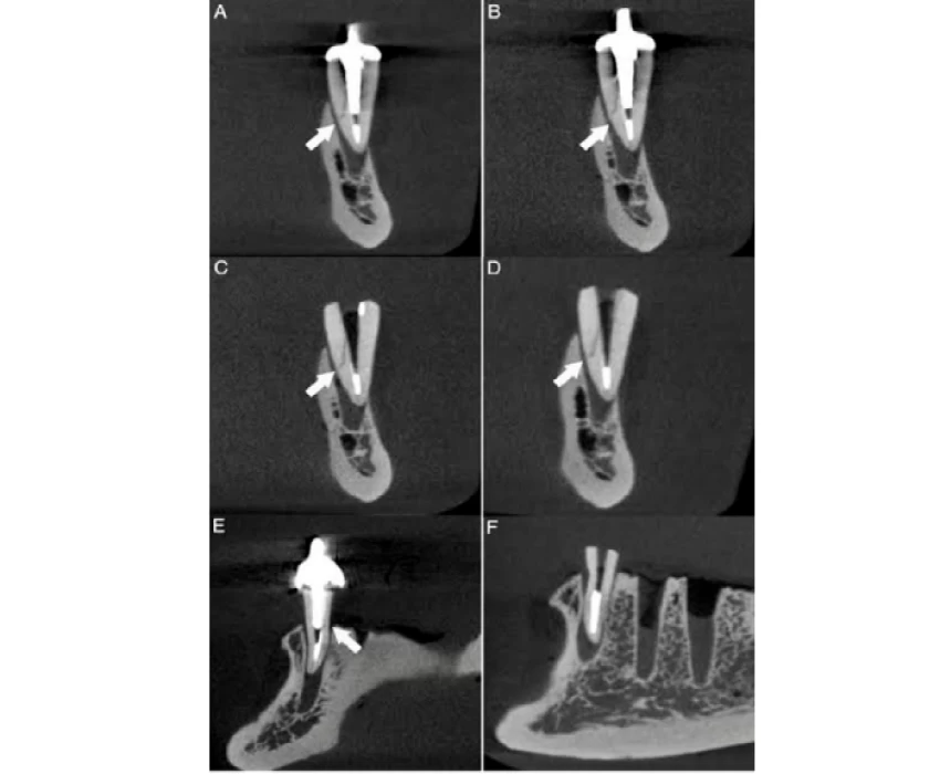 saraswati dental college