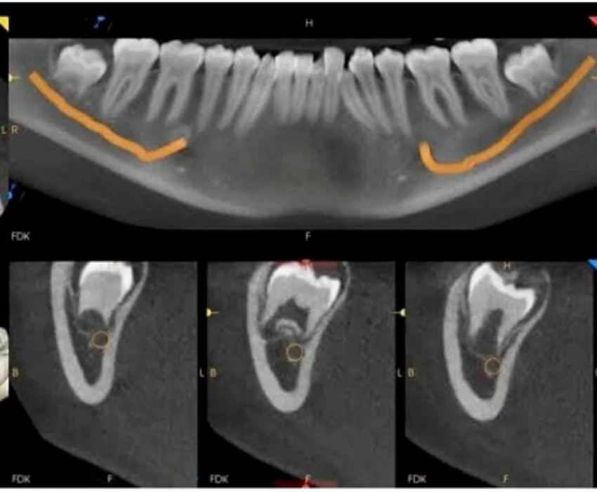saraswati dental college