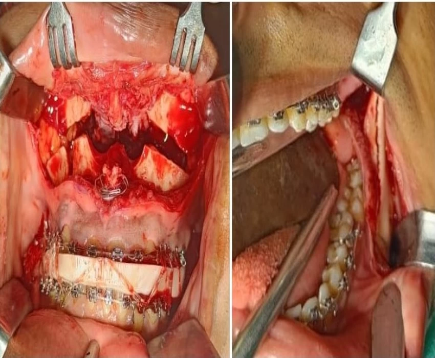 saraswati dental college
