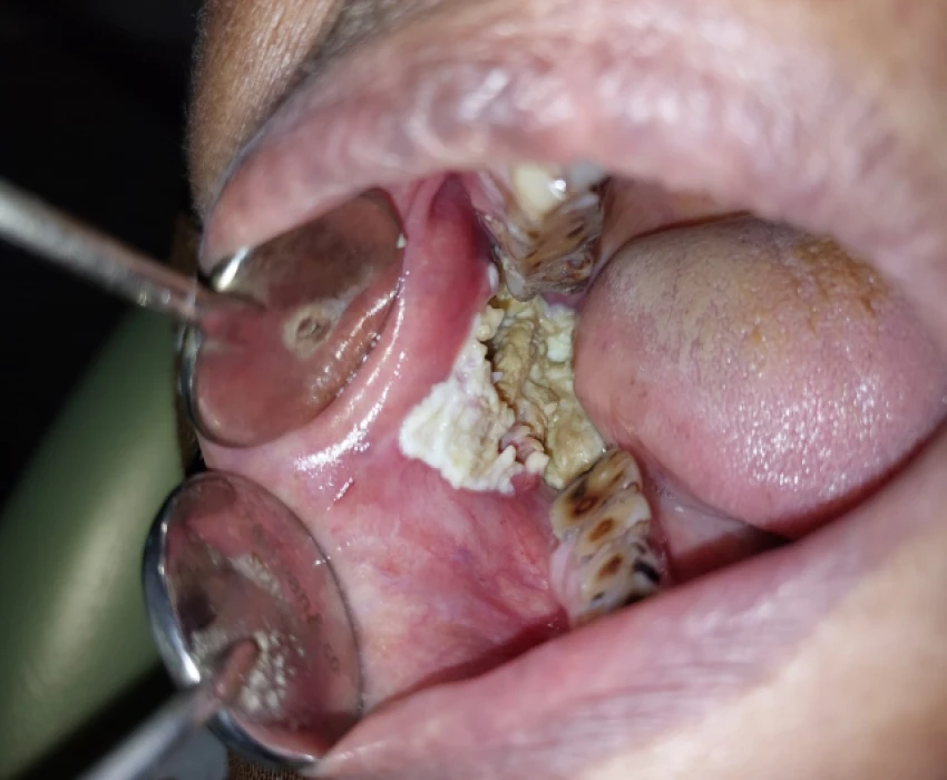 saraswati dental college