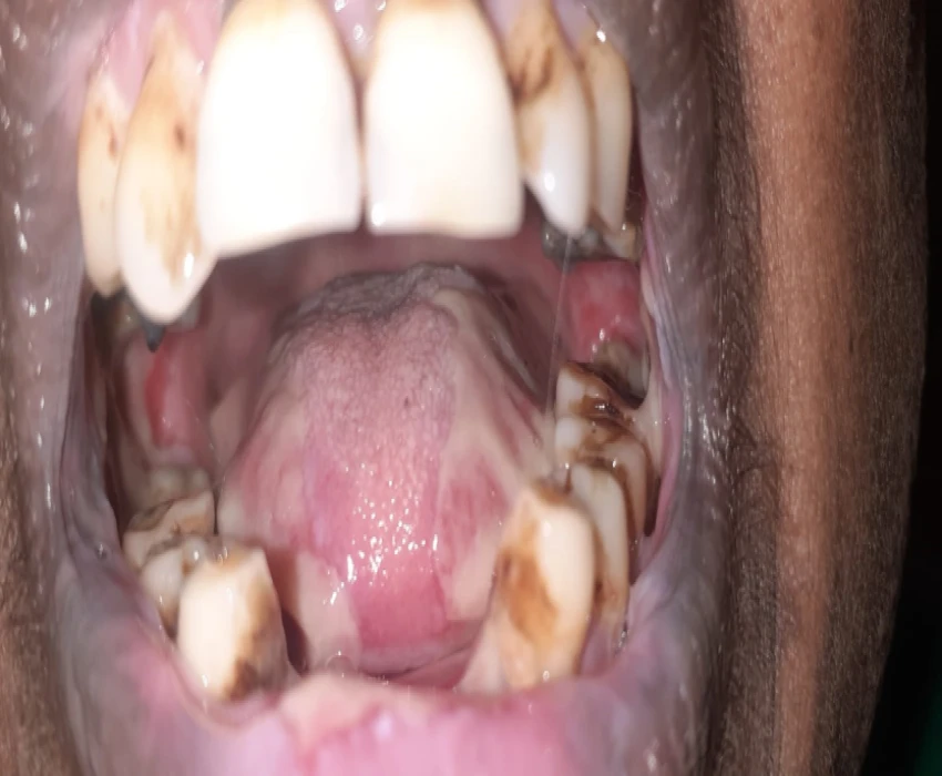 saraswati dental college