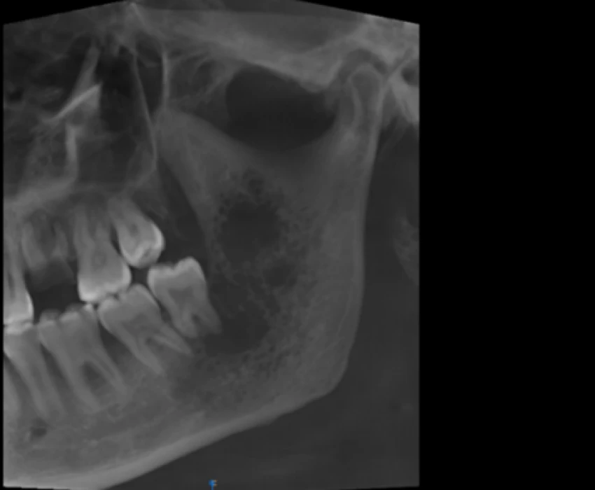 saraswati dental college