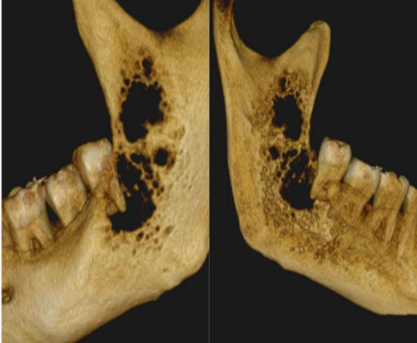saraswati dental college