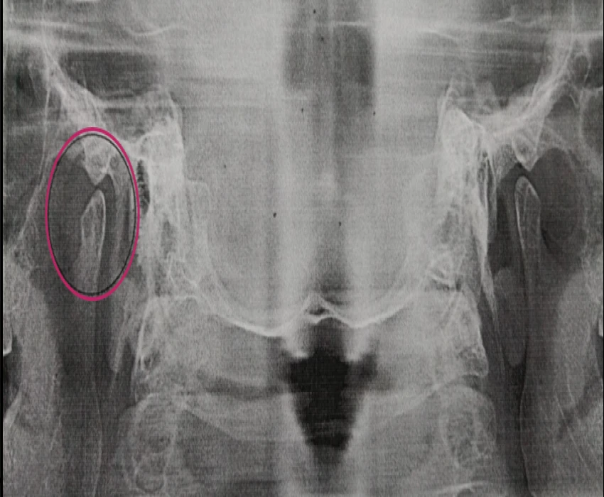 saraswati dental college