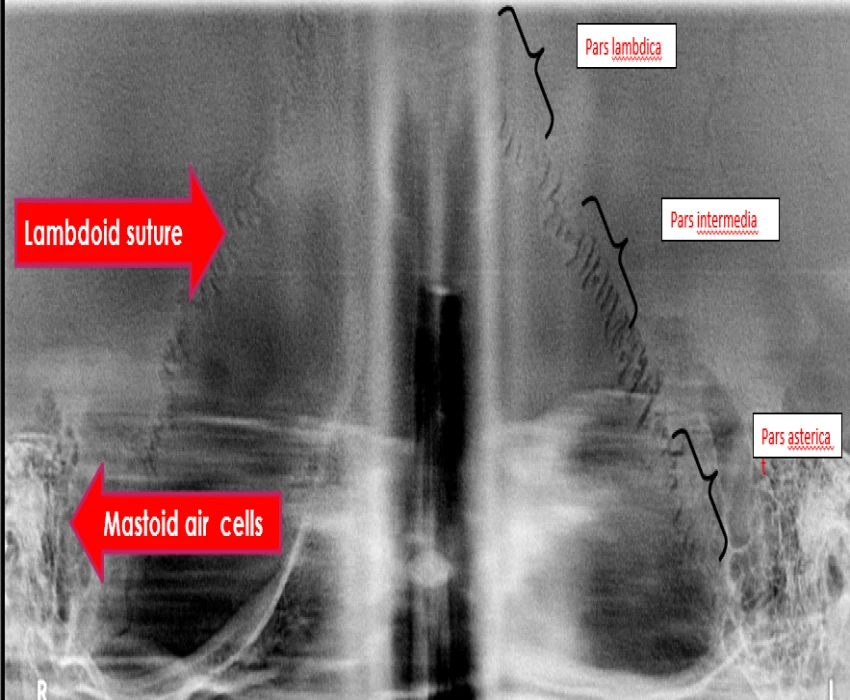 saraswati dental college