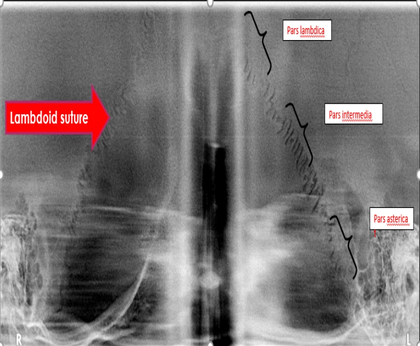 saraswati dental college