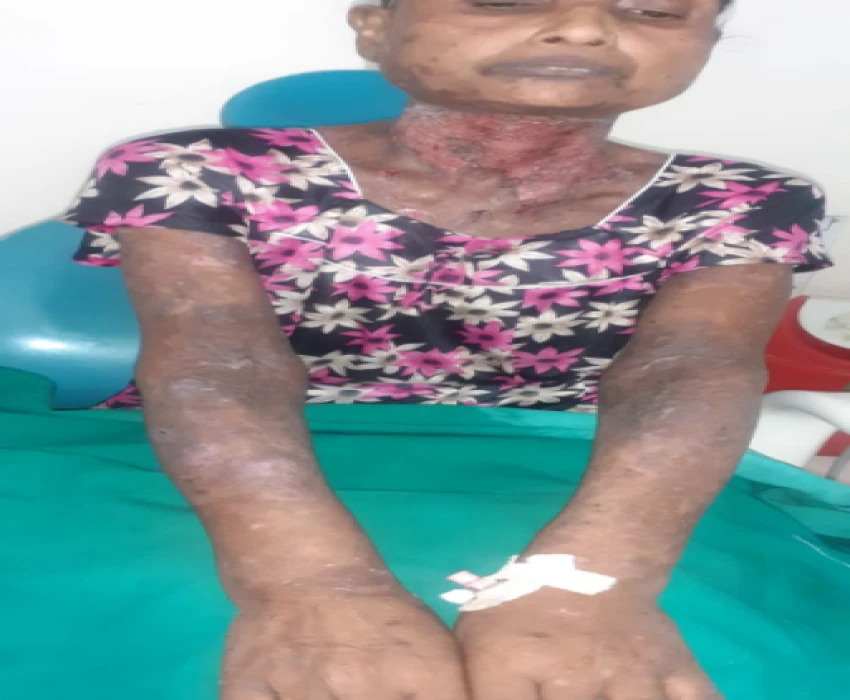 saraswati dental college