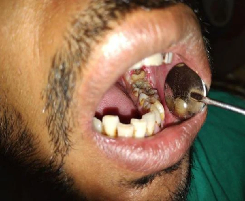 saraswati dental college