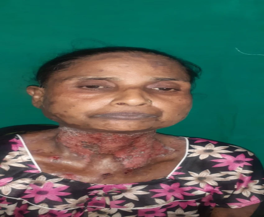 saraswati dental college