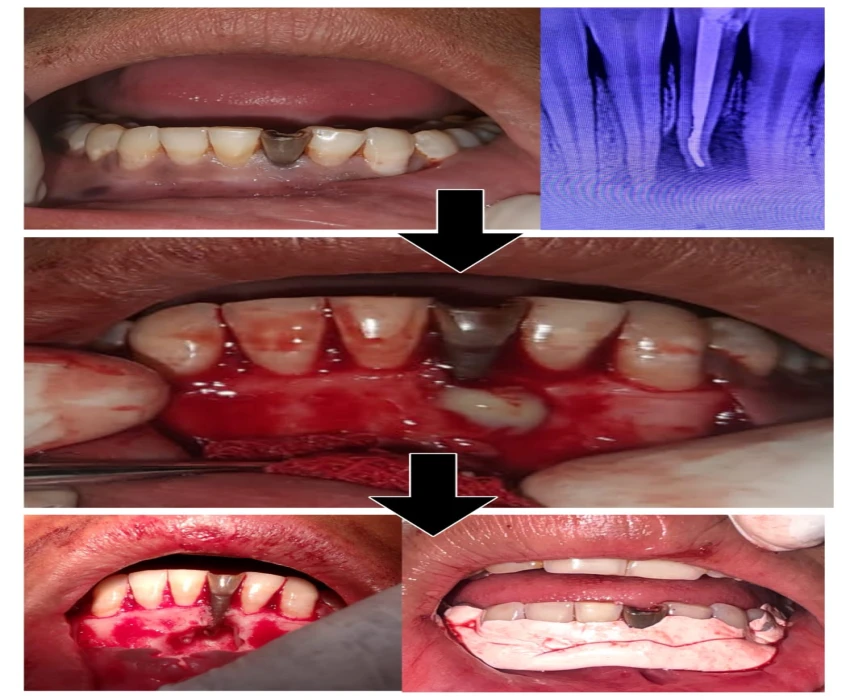saraswati dental college