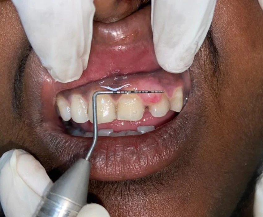 saraswati dental college