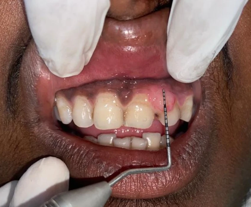 saraswati dental college