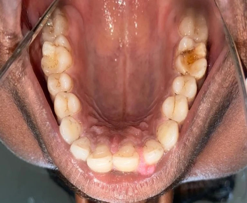 saraswati dental college