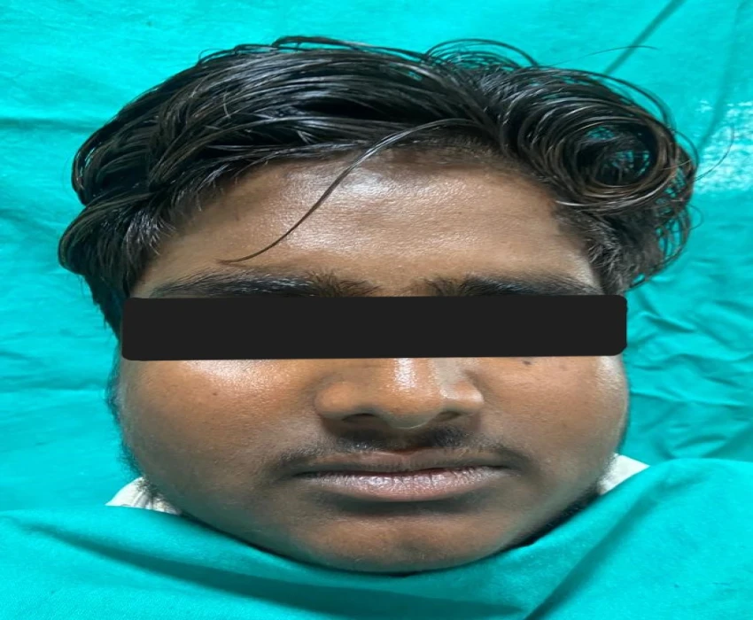 saraswati dental college