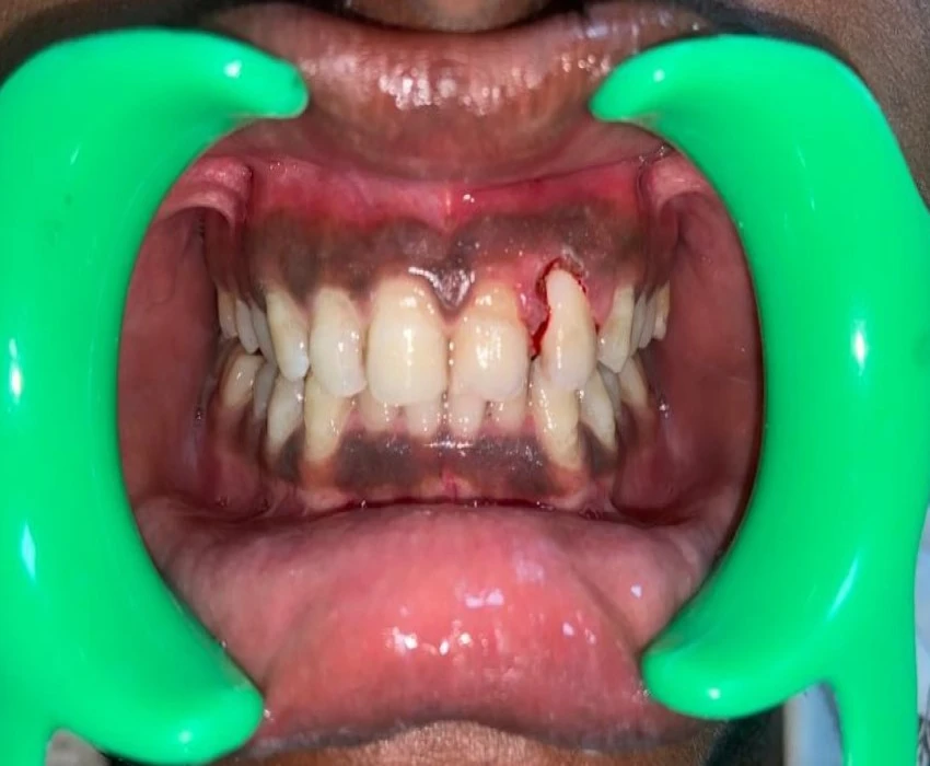 saraswati dental college