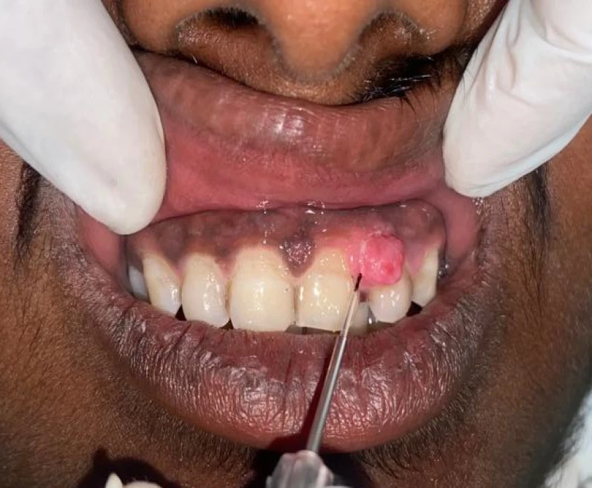 saraswati dental college