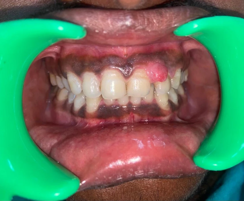 saraswati dental college