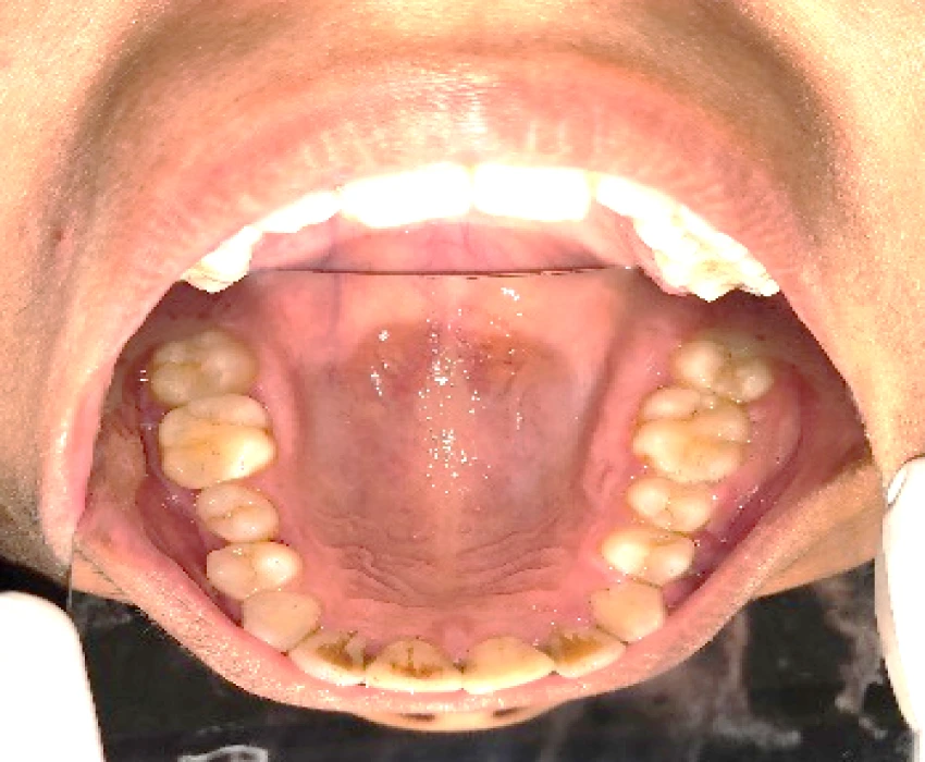 saraswati dental college