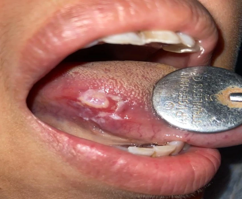 saraswati dental college