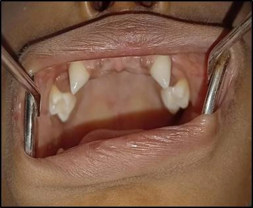 saraswati dental college