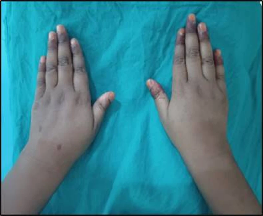 saraswati dental college