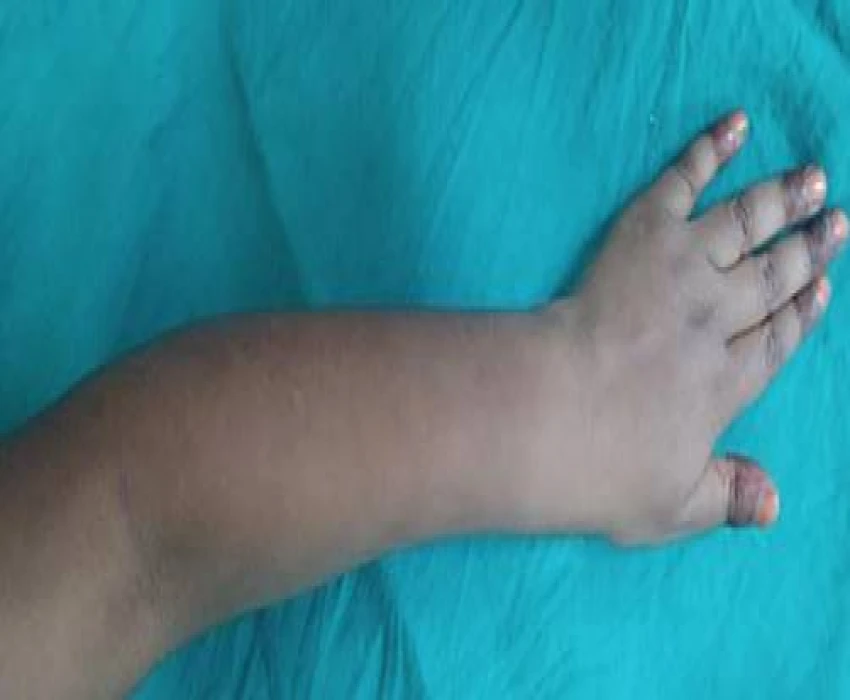 saraswati dental college