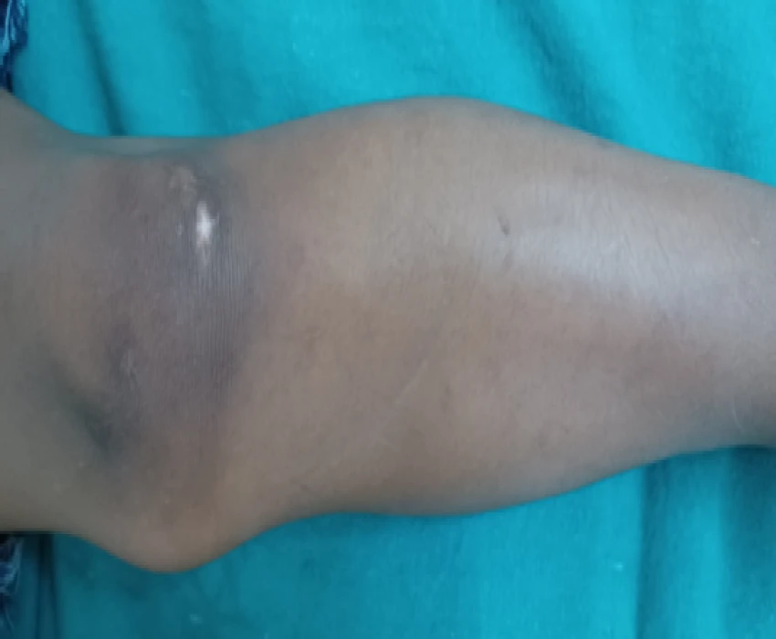 saraswati dental college