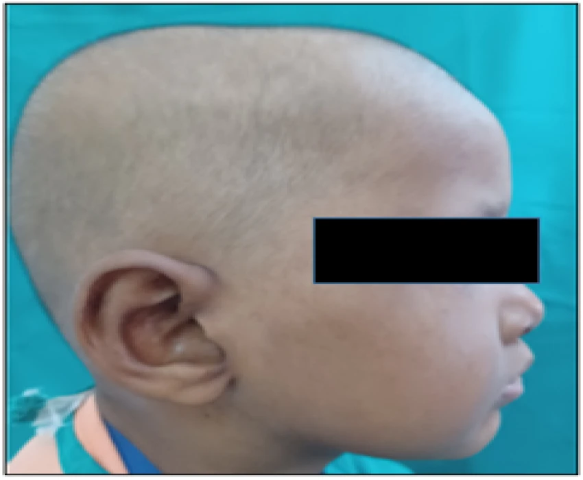 saraswati dental college