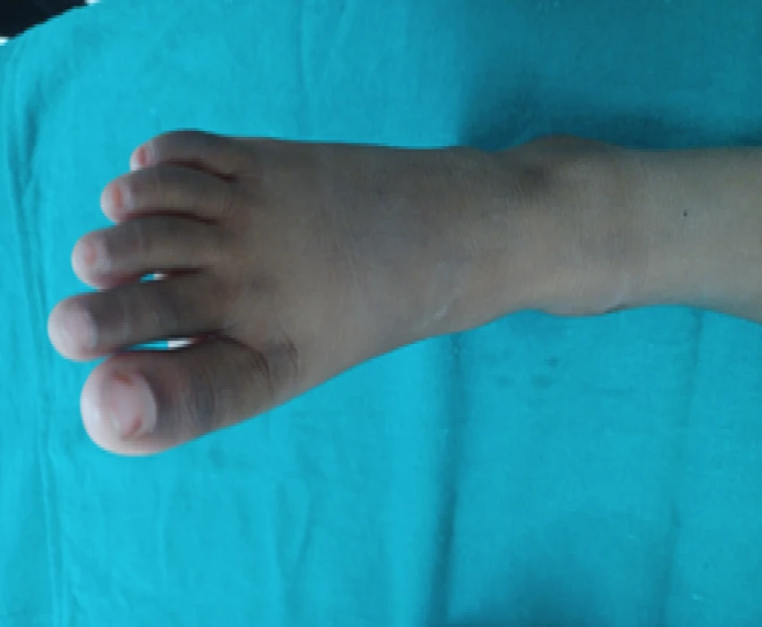 saraswati dental college