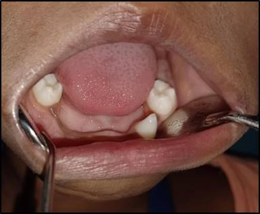 saraswati dental college