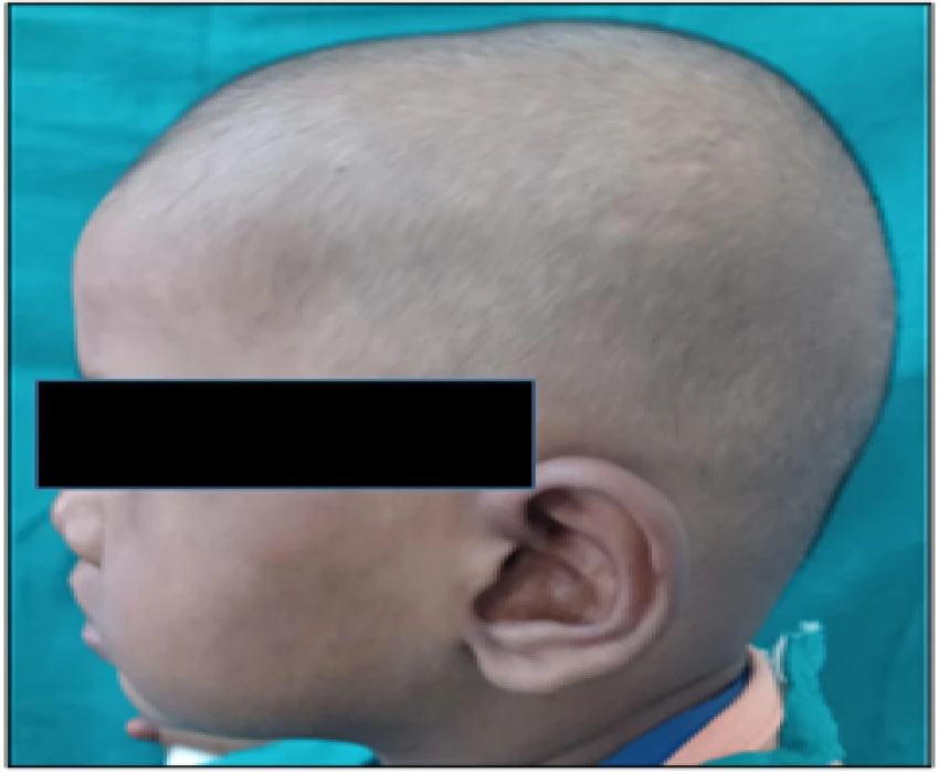 saraswati dental college