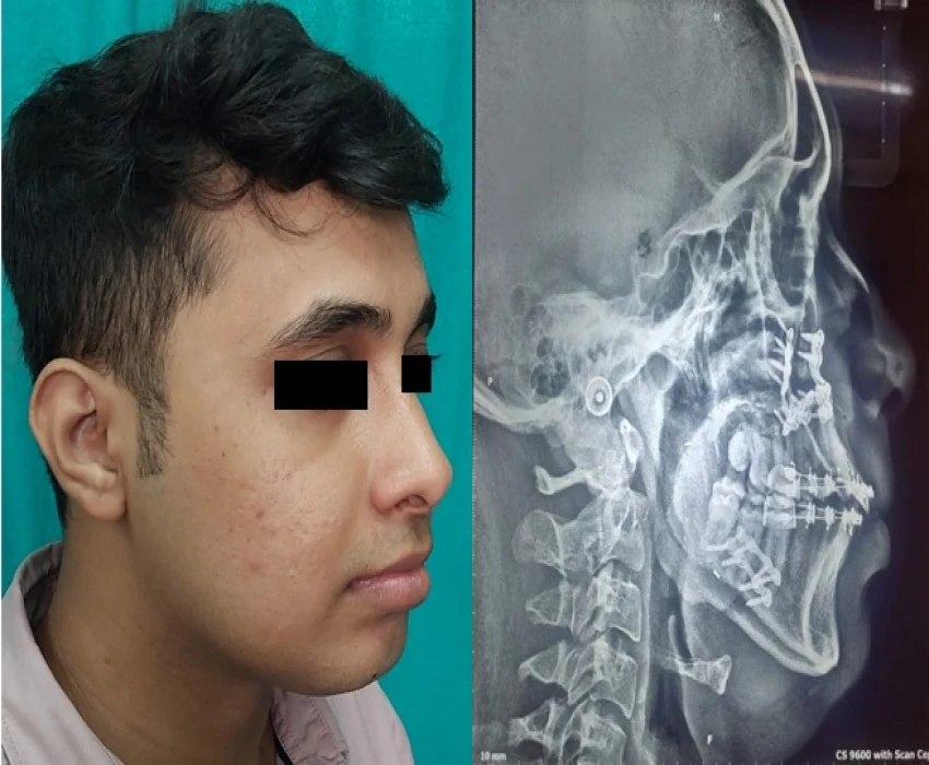 saraswati dental college