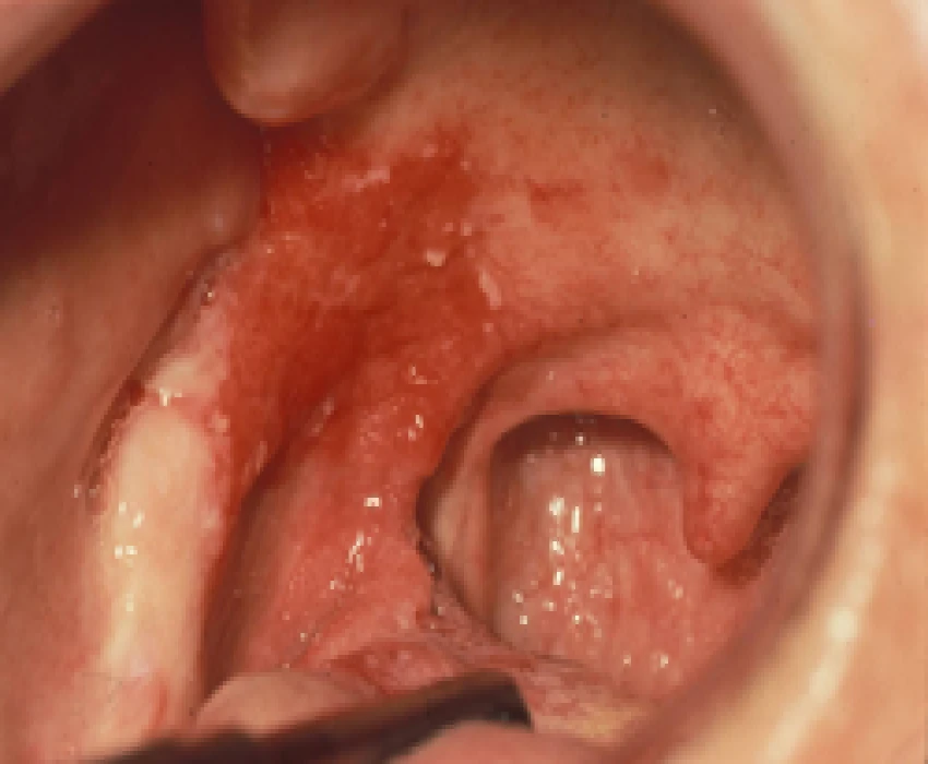 saraswati dental college