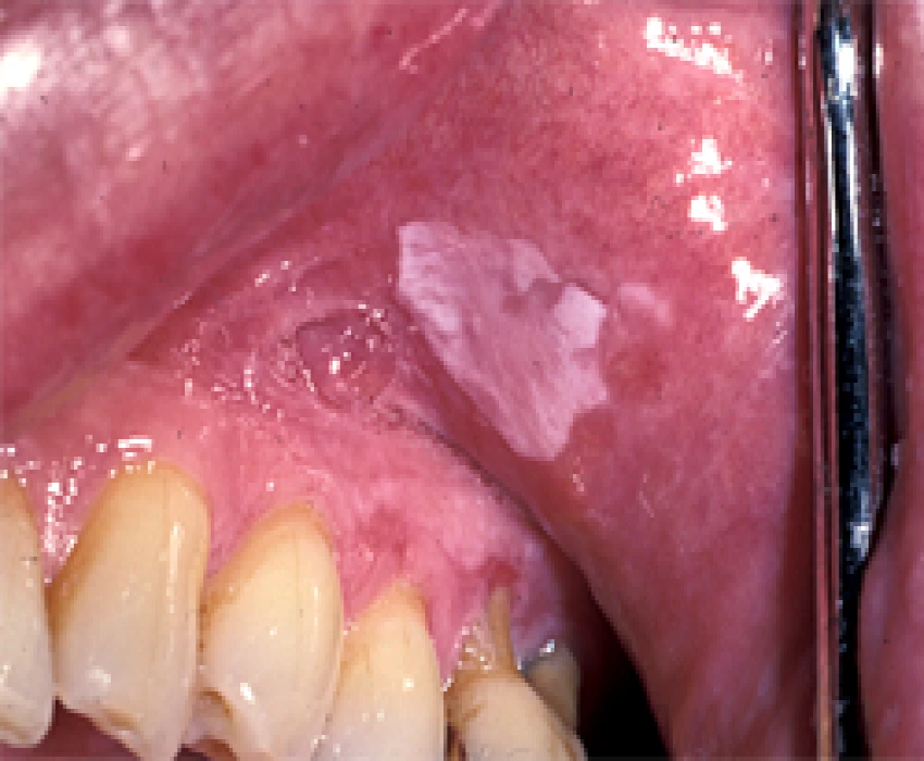 saraswati dental college