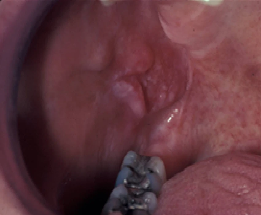 saraswati dental college