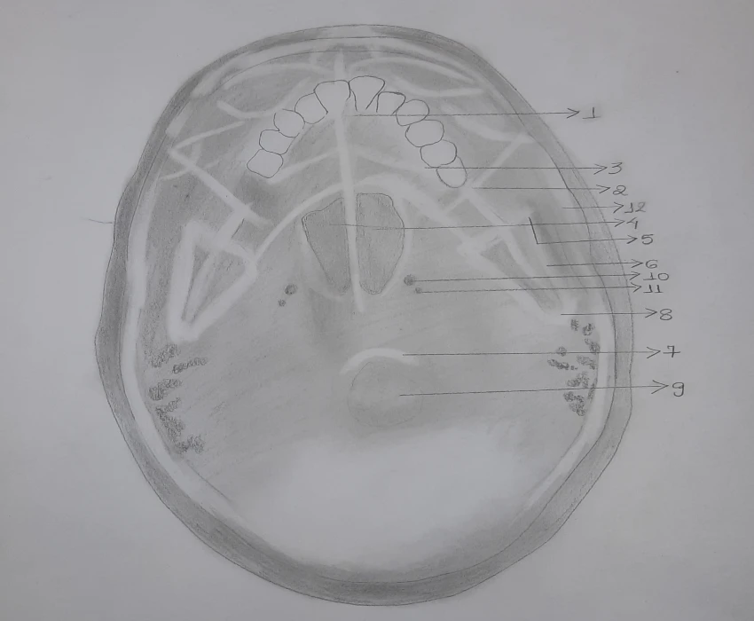 Tracing Radiograph Nail your Basics First, Basics Strengthens your Foundation ...