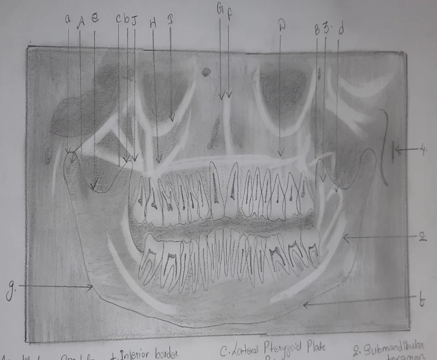 Tracing Radiograph Nail your Basics First, Basics Strengthens your Foundation ...