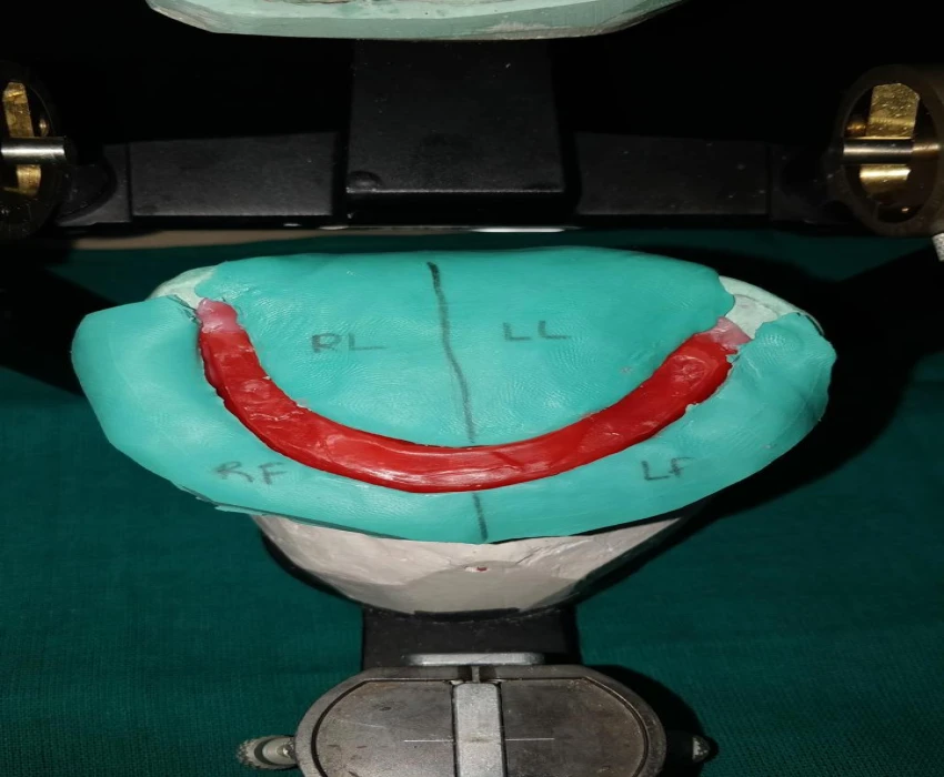 saraswati dental college