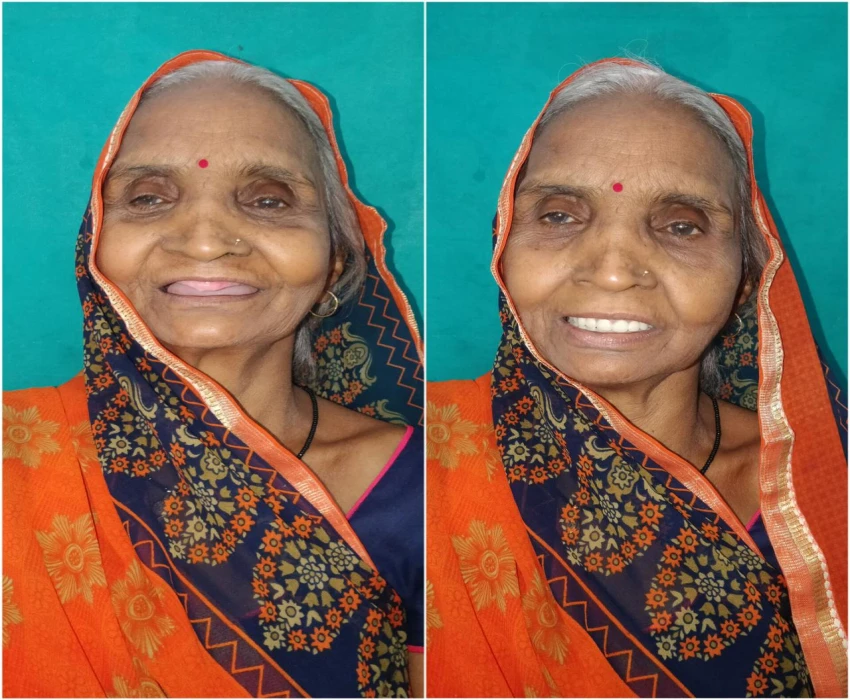 saraswati dental college