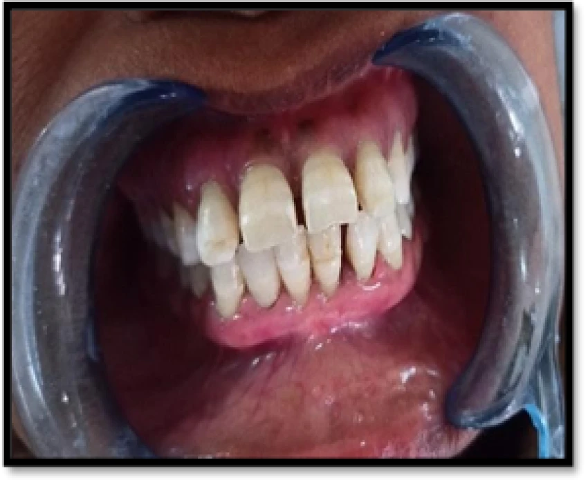 saraswati dental college