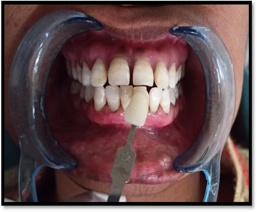 saraswati dental college