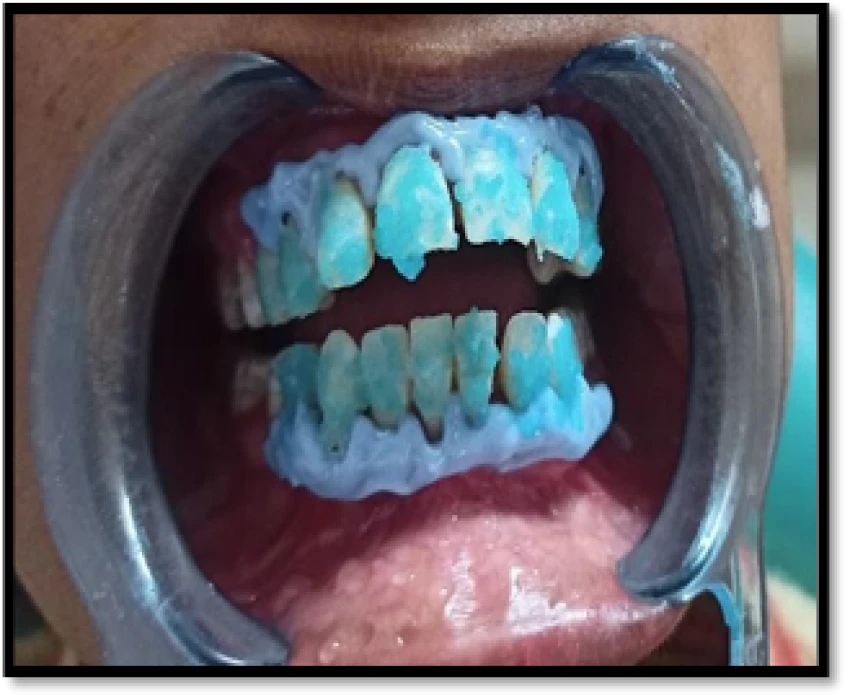 saraswati dental college