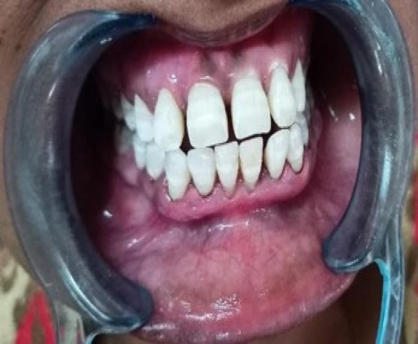 saraswati dental college